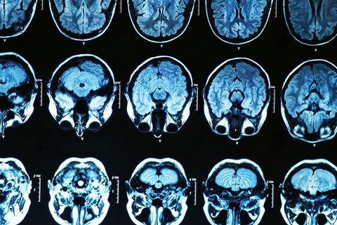 Um Spezialfälle zu lösen, hilft dem Arzt ein genauer Blick in den Schädel