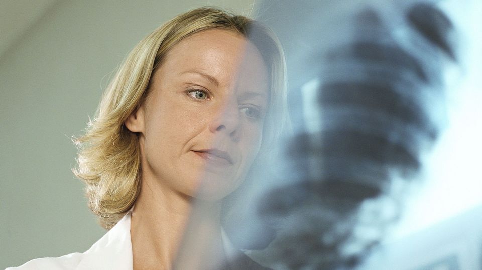 Fachärzte erkennen anhand von Röntgenbildern, ob auch die Lunge in Mitleidenschaft gezogen ist
