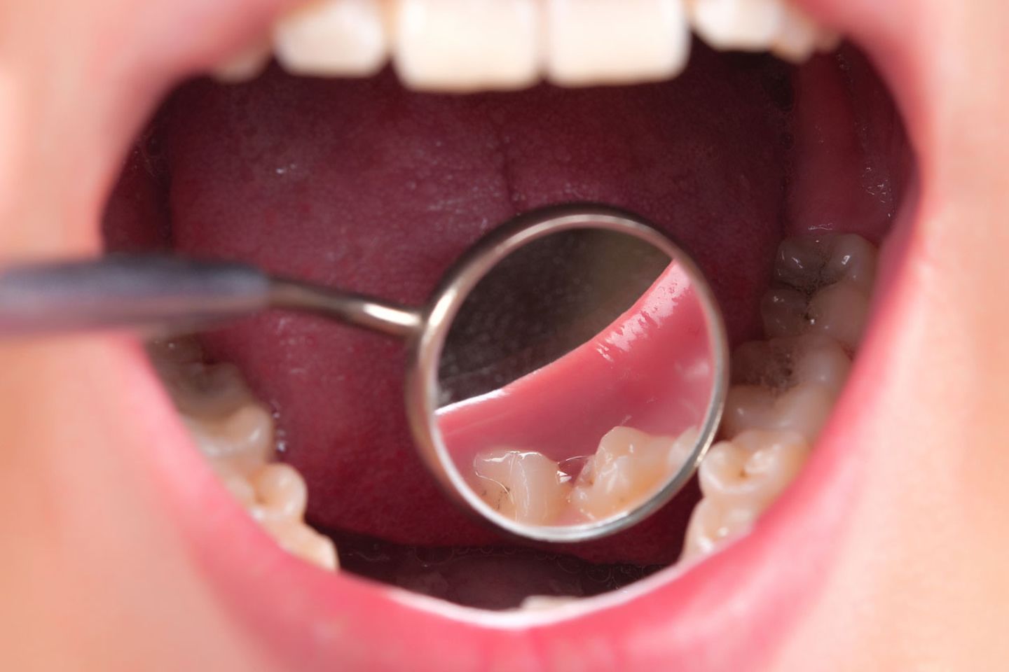 Der Zahnarzt schaut genau hin: Schert der Unterkiefer zur Seite aus?