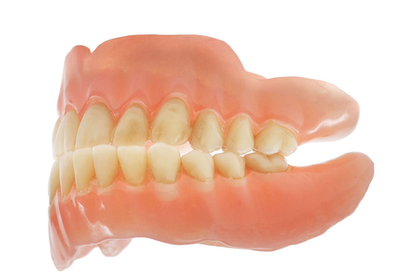 Nicht immer passt das so gut: Klappen die Kiefer zu schief aufeinander, kann das Zähne kosten