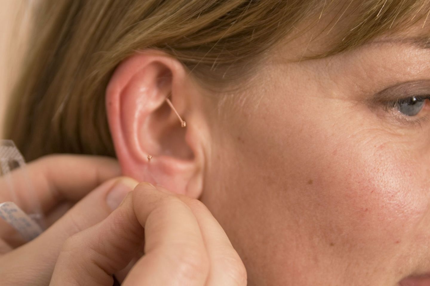 Das Ohr: In der Muschel liegen besonders viele Akupunkturpunkte