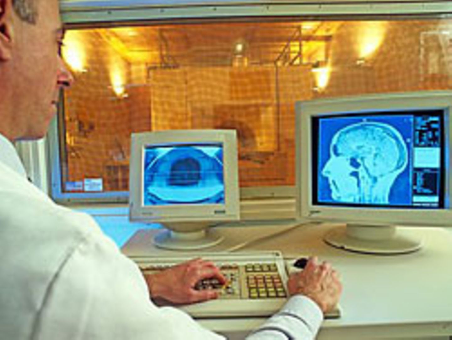 Normalerweise sind für die Entwicklung des Gesichtsfeldes beide Hirnhälften nötig