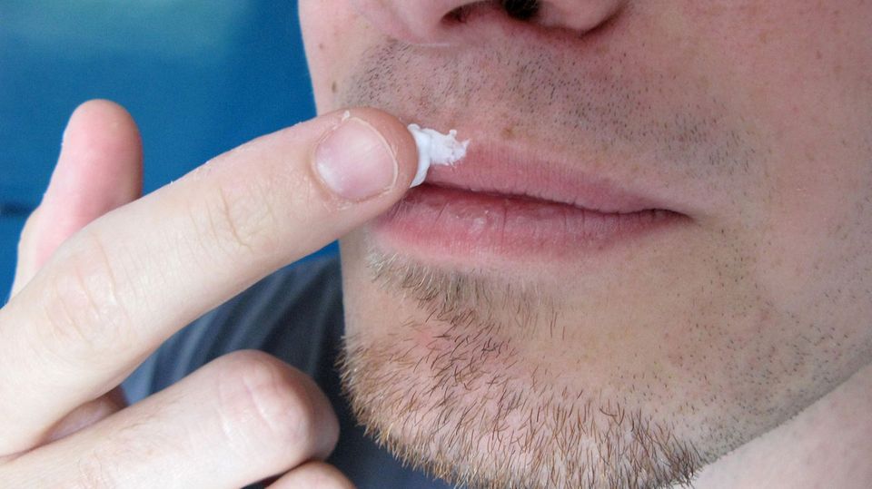 Mund durchsichtiges bläschen im Weiße Blasen