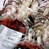 Blutiges Schlamassel    1920 erfand der russische Physiker Alexander Bogdanov die Bluttransfusion. Er war überzeugt, dass sie das Geheimnis ewiger Jugend sei. Bis er 1928 seine elfte und letzte Bluttransfusion von einem seiner Studenten erhielt, der unglücklicherweise an Malaria und Tuberkulose litt. Bogdanov starb kurz darauf  (gefunden in "T3 - The Gadget Magazine")