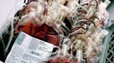 Blutiges Schlamassel    1920 erfand der russische Physiker Alexander Bogdanov die Bluttransfusion. Er war überzeugt, dass sie das Geheimnis ewiger Jugend sei. Bis er 1928 seine elfte und letzte Bluttransfusion von einem seiner Studenten erhielt, der unglücklicherweise an Malaria und Tuberkulose litt. Bogdanov starb kurz darauf  (gefunden in "T3 - The Gadget Magazine")