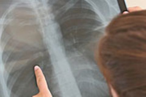 Nanopartikel können ins Lungengewebe eindringen - mit tödlichen Folgen