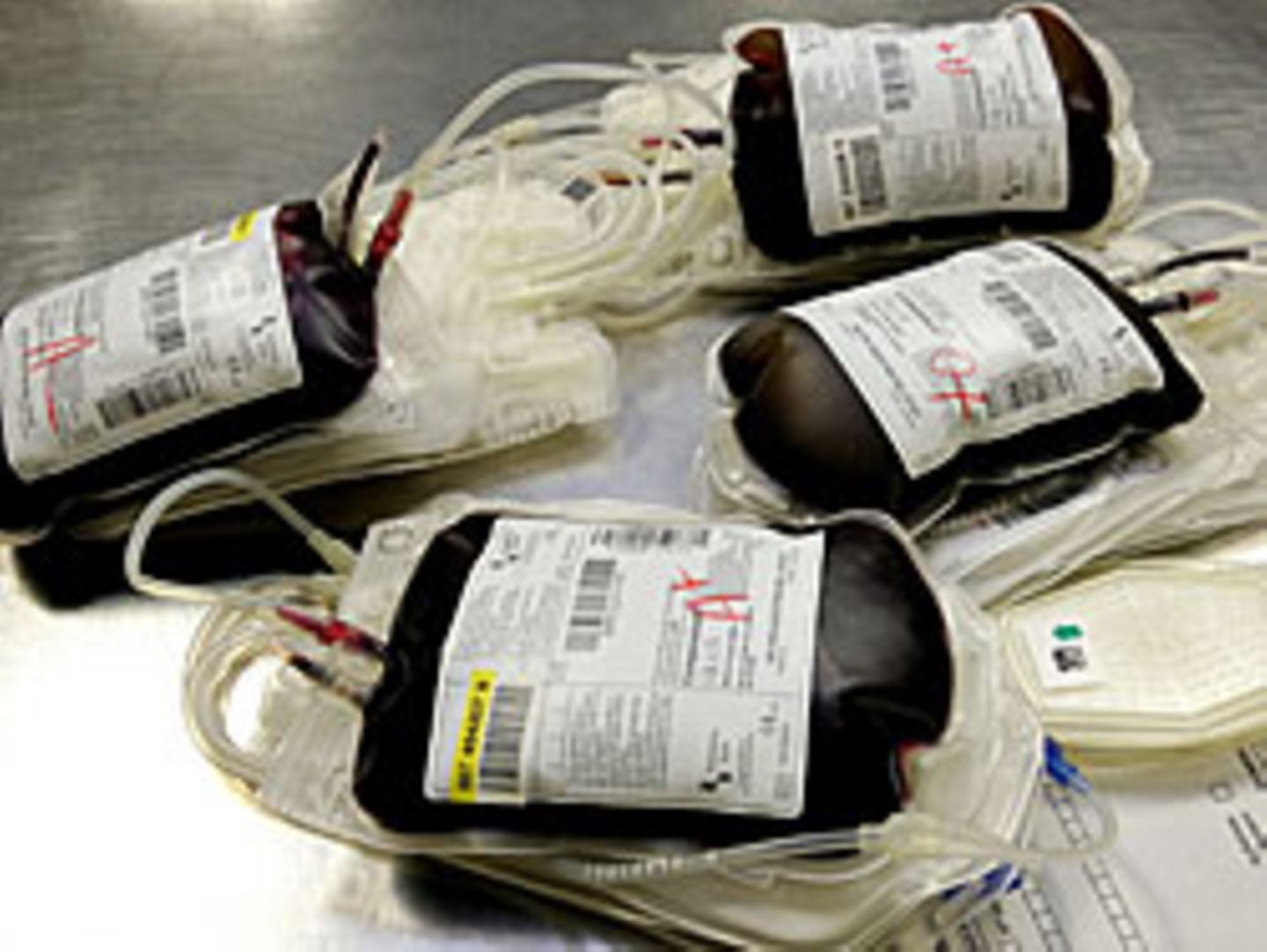 Beim Blutdoping steigen eigentlich auch die Hämoglobinwerte