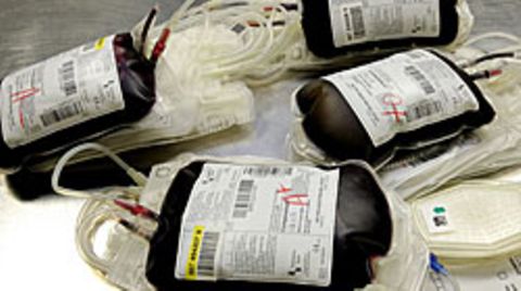 Beim Blutdoping steigen eigentlich auch die Hämoglobinwerte