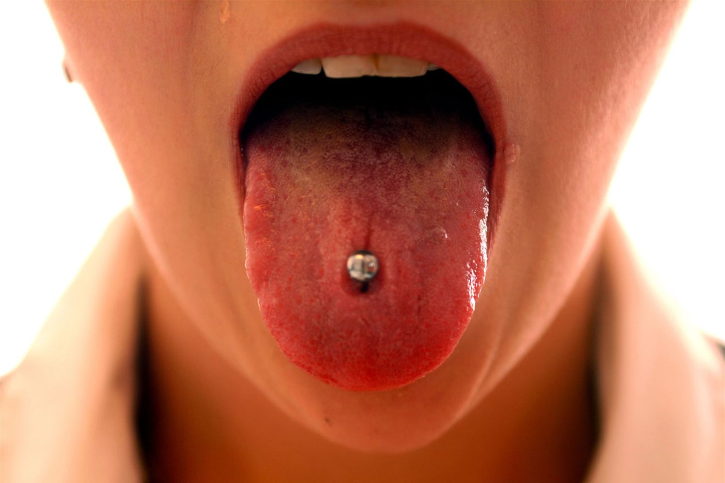 Es dauert bis zu drei Monate, bis ein Zungen-Piercing komplett ausgeheilt ist