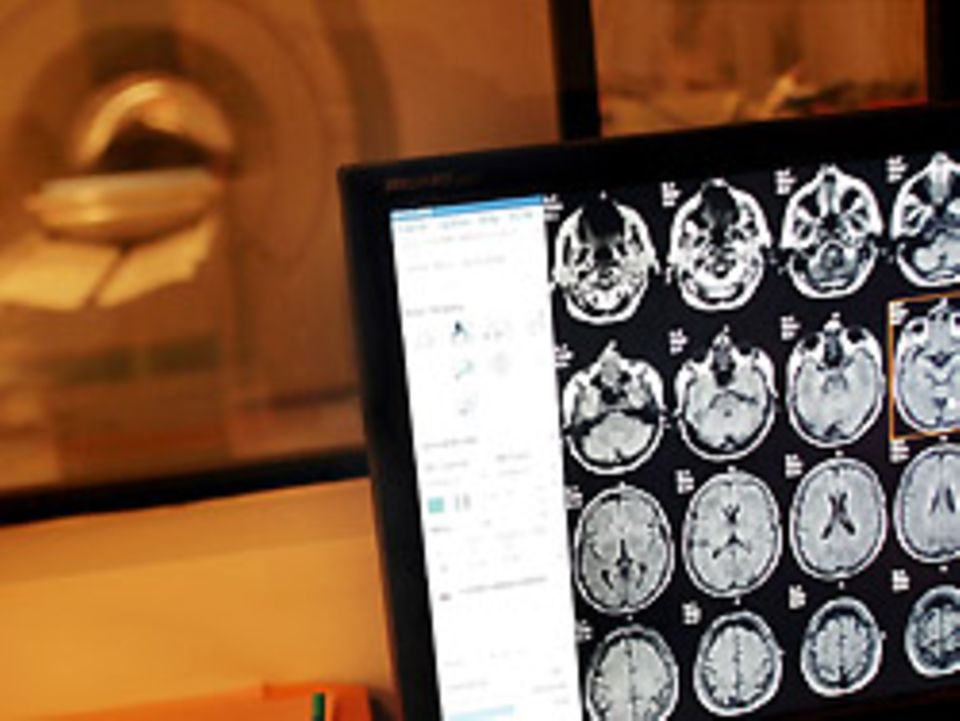 Alzheimer: Im Kernspin zeigen sich Alzheimer-bedingte Schrumpfungen des Gehirns Im Kernspin zeigen sich Alzheimer-bedingte Schrumpfungen des Gehirns