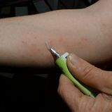 Bevorzugen Sie Hautpflegeprodukte, die in Aluminiumtuben verpackt sind. In Tiegel können leicht Keime eindringen. Plastiktuben saugen die Creme - und damit Luft und Keime - zurück, wenn der Benutzer sie loslässt