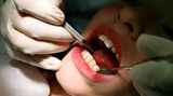 Loben Sie Ihr Kind nach einem Zahnarztbesuch, statt ihm etwas zu schenken. Sonst setzt sich bei ihm der Eindruck fest, dass die Zahnbehandlung etwas ganz Außergewöhnliches ist. Falls wirklich Schmerzen auf Ihr Kind zukommen, sollten Sie es darauf vorbereiten.
