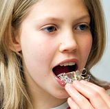 Setzen Sie beim Sport die Zahnspange nicht ein, es sei denn, der Zahnarzt hat Ihnen ausdrücklich dazu geraten. Die Spange kann leicht beschädigt werden oder Sie können sich im Mundraum verletzen