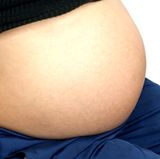 Platz 5: Schwangerschaft    Ein dicker Bauch zerrt am Rücken. Muskeln, Bänder und Gelenke sind dann schnell überfordert und werden leicht instabil. Das kann den Rücken schmerzen lassen - auch noch lange nach der Geburt.  Hier finden Mütter Tipps, was den Rücken vor und nach der Geburt schont