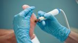 Behandeln Sie nicht Ihre Hühneraugen nicht selbst, sondern gehen Sie lieber zur medizinischen Fußpflege: Das Personal dort sollte sich mit Füßen von Patienten mit Diabetes auskennen