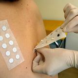 Wenn ein Hauttest bei Ihnen ergeben hat, dass Sie auf ein bestimmtes Nahrungsmittel sensibel reagieren, müssen Sie dieses nur meiden, wenn tatsächlich eine Reaktion auftritt, oder wenn ein Provokationstest  die Allergie bestätigt hat. Eine Lebensmittelallergie kann mit der Zeit schwächer werden oder ganz verschwinden. Deshalb sollten Sie regelmäßig vom Arzt prüfen lassen, ob sie noch besteht