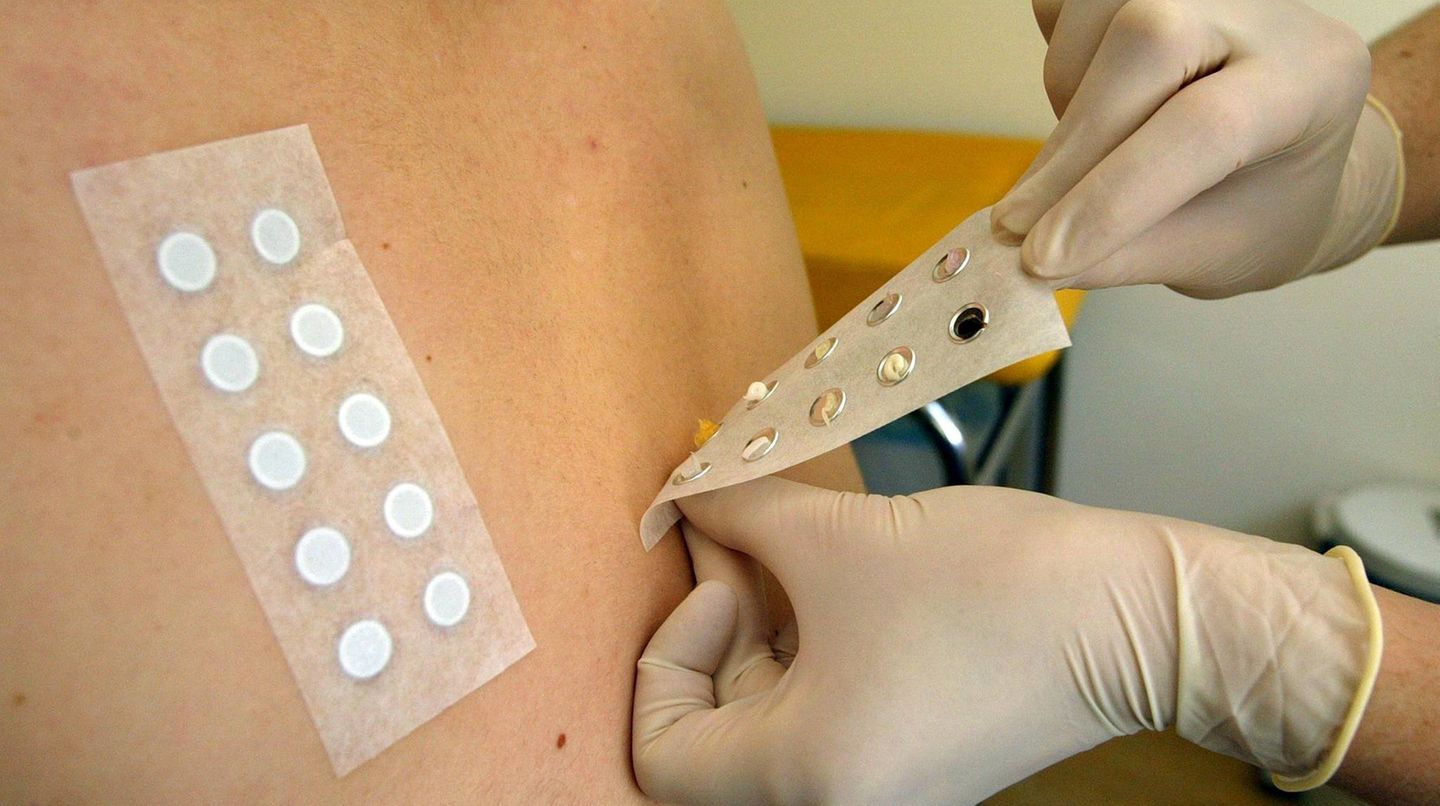 Tipps bei Lebensmittelallergie: Wenn ein Hauttest bei Ihnen ergeben hat, dass Sie auf ein bestimmtes Nahrungsmittel sensibel reagieren, müssen Sie dieses nur meiden, wenn tatsächlich eine Reaktion auftritt, oder wenn ein Provokationstest die Allergie bestätigt hat. Eine Lebensmittelallergie kann mit der Zeit schwächer werden oder ganz verschwinden. Deshalb sollten Sie regelmäßig vom Arzt prüfen lassen, ob sie noch besteht Wenn ein Hauttest bei Ihnen ergeben hat, dass Sie auf ein bestimmtes Nahrungsmittel sensibel reagieren, müssen Sie dieses nur meiden, wenn tatsächlich eine Reaktion auftritt, oder wenn ein Provokationstest die Allergie bestätigt hat. Eine Lebensmittelallergie kann mit der Zeit schwächer werden oder ganz verschwinden. Deshalb sollten Sie regelmäßig vom Arzt prüfen lassen, ob sie noch besteht