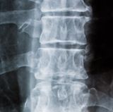 Platz 9: ein Arzt    Jede ärztliche Diagnose, sei sie auch noch so unerheblich, verstärkt das Problem: Der Rückenschmerz setzt sich fest - schließlich hat der Arzt ja etwas gefunden.  Wie gut kennen Sie sich mit Ihrem Rücken aus? Ihr Wissen können Sie hier testen