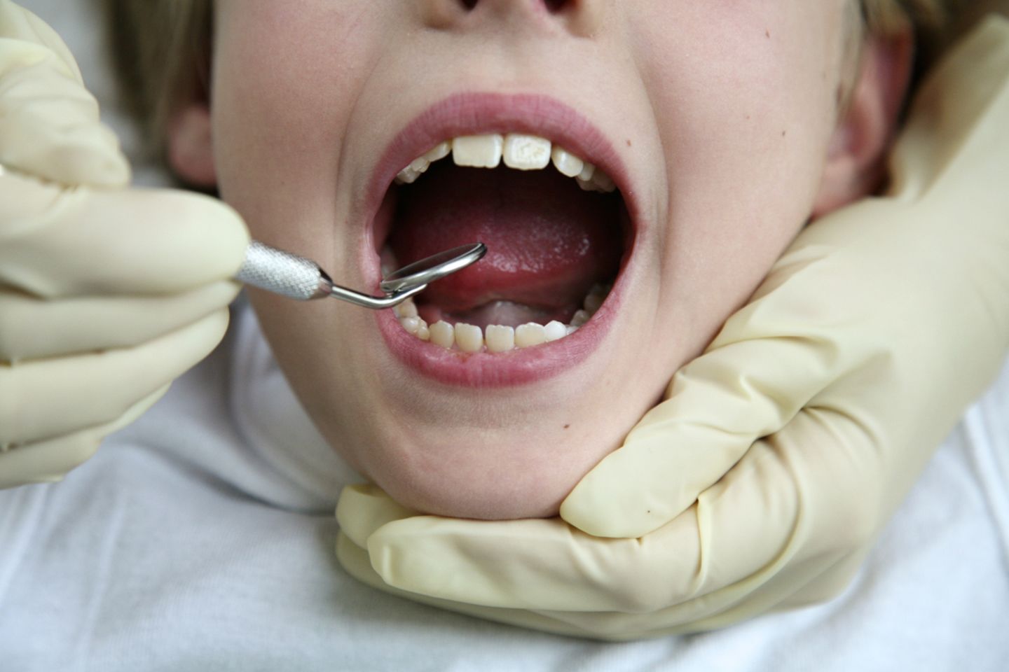 Beliebte Zusatzleistung beim Zahnarzt: die profesionelle Zahnreinigung. Nutzen: unklar.