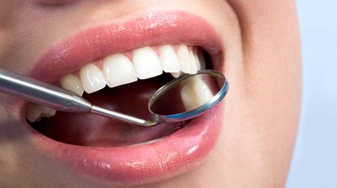 Infografik: So verändert Parodontose Zahn und Zahnfleisch