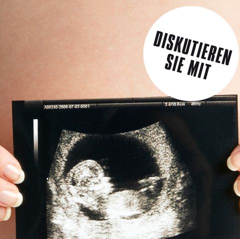 Eine schwangere Frau zeigt die Ultraschallaufnahme ihres Kindes