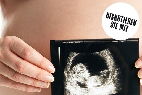 Eine schwangere Frau zeigt die Ultraschallaufnahme ihres Kindes