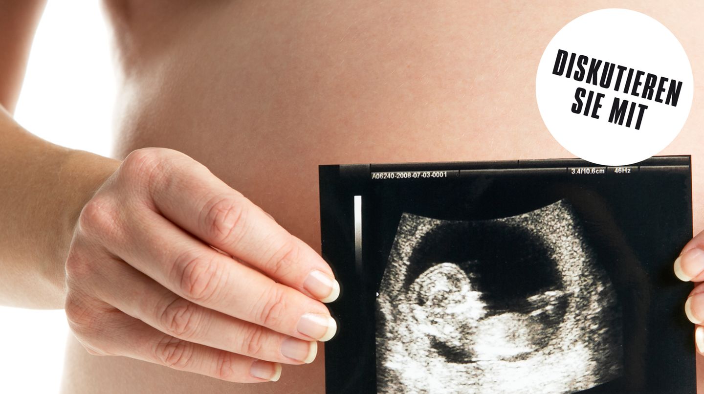 Eine schwangere Frau zeigt die Ultraschallaufnahme ihres Kindes