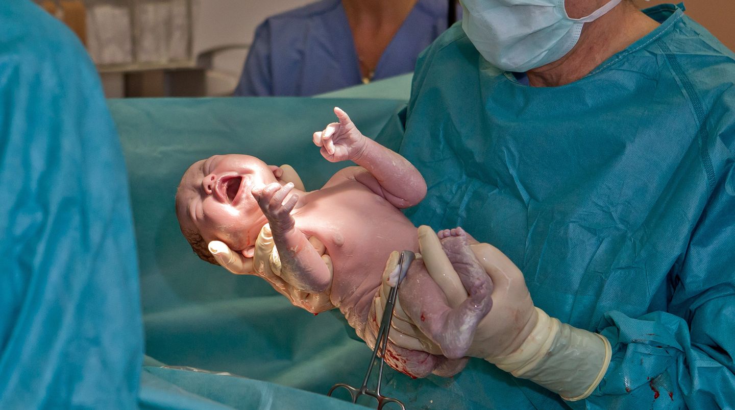 Ein Kaiserschnitt sollte die Ausnahme sein, da er viele Risiken für Mutter und Kind birgt. In Brasilien gibt es so viele Kaiserschnittgeburten wie nirgendwo sonst auf der Welt.