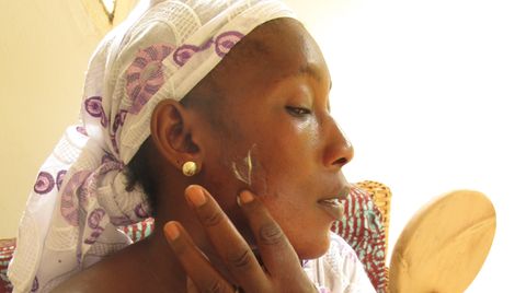 Im Namen der Schönheit: Die Textilarbeiterin Bintou Dembele nutzt Bleichcremes zum Aufhellen ihrer Haut.  Sie weiß um die gesundheitlichen Risiken und tut es dennoch.