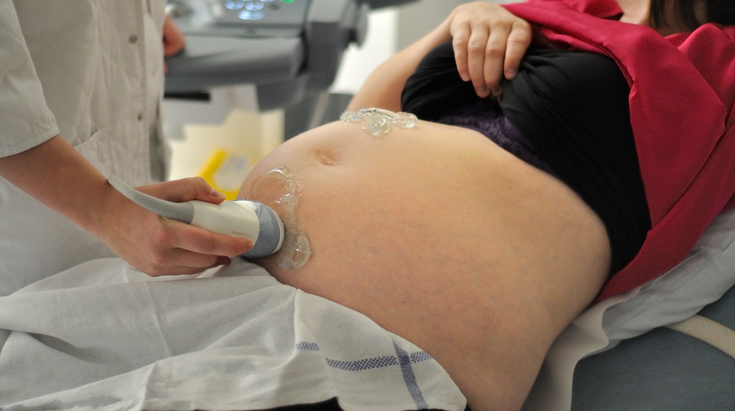 Eine Ärztin untersucht eine Schwangere mithilfe von Ultraschall