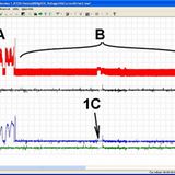Die Messung eines Ford Mondeo 1.8 TDCi durch FCD zeigt, dass die Abgasrückführung, die auch nach mehreren Zündungen weiterhin ab