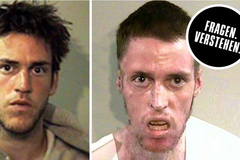 Crystal Meth Abhängiger: Vorher-Nachher Vergleichsbild