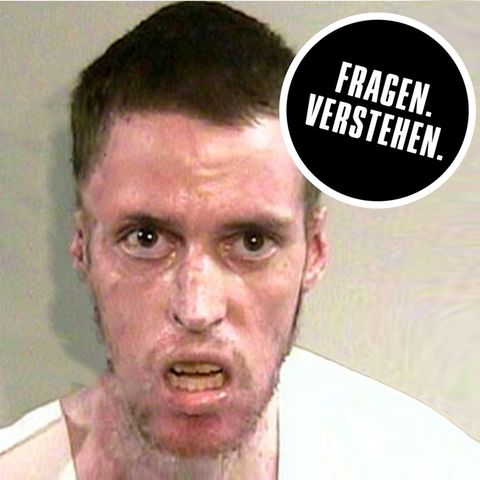 Crystal Meth Abhängiger: Vorher-Nachher Vergleichsbild