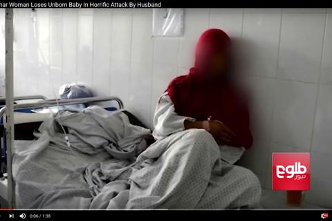 Die 21-jährige Frau aus Afghanistan wurde von ihrem Ehemann, seiner Mutter und Schwester schwer misshandelt
