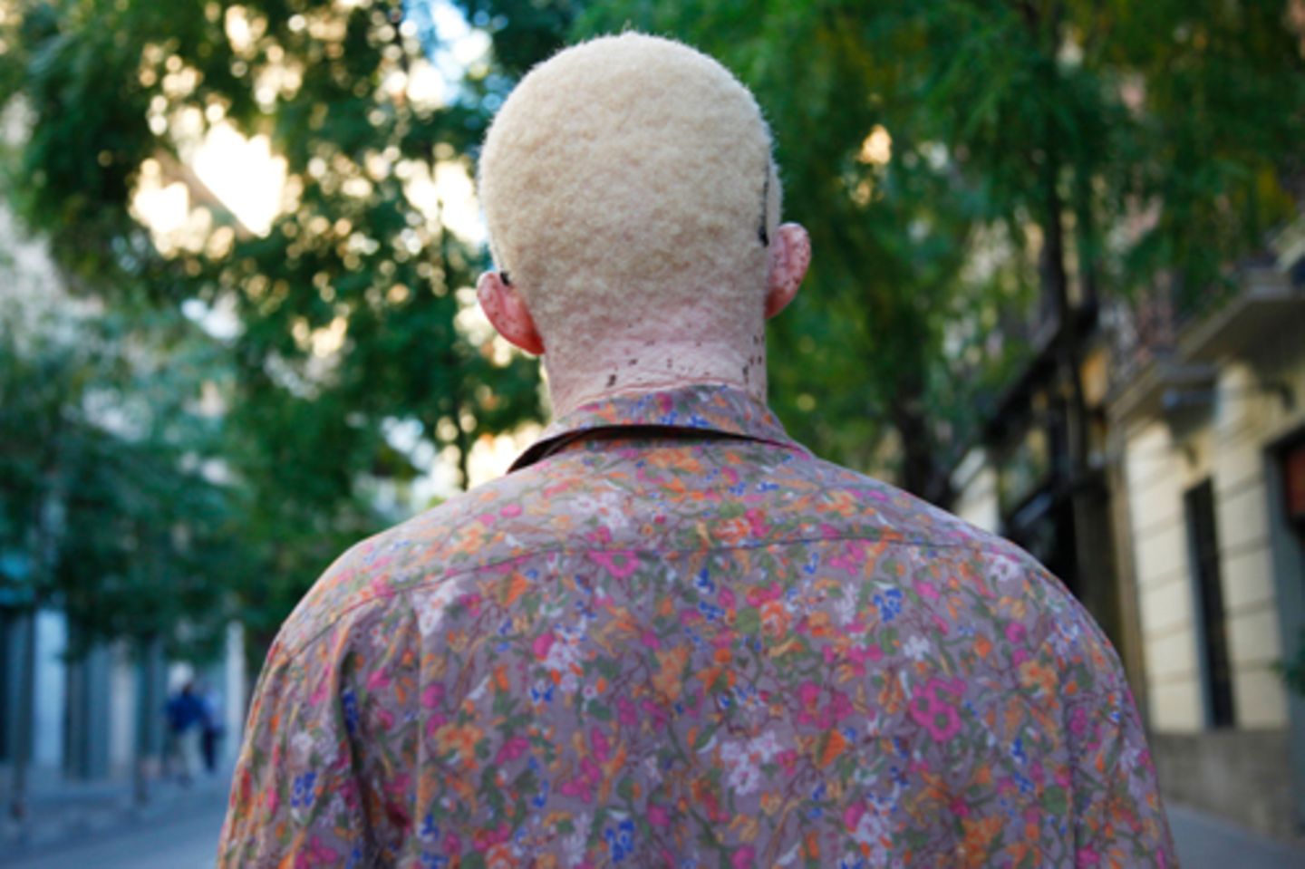Albinismus in Afrika: Abdul Coulibaly von hinten