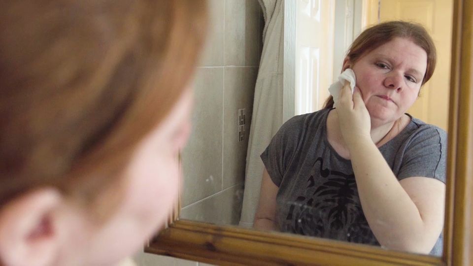 Seltenes Leiden: Diese Frau riecht immer nach Fisch, egal wie oft sie sich wäscht