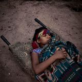 Saraswati liegt auf einer Trage. Sie kann nicht mehr laufen, hat hohes Fieber und ist ohnmächtig geworden. Der psychische Stress und die Anstrengung der Geburt haben ihr stark zugesetzt. 