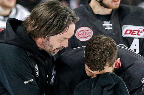 Yasin Ehliz (r.) von den Nürnberg Ice Tigers scheint sein zerfetztes Ohr nicht sonderlich zu stören
