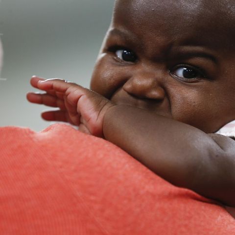 Dominique kam mit zusätzlichen Beinen auf die Welt, die von einem parasitären Zwilling stammten