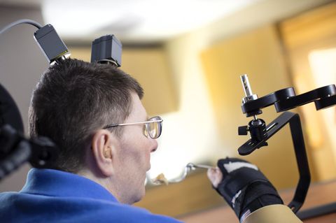 Neuroprothese: Durchbruch bei Behandlung von schwersten Lähmungen
