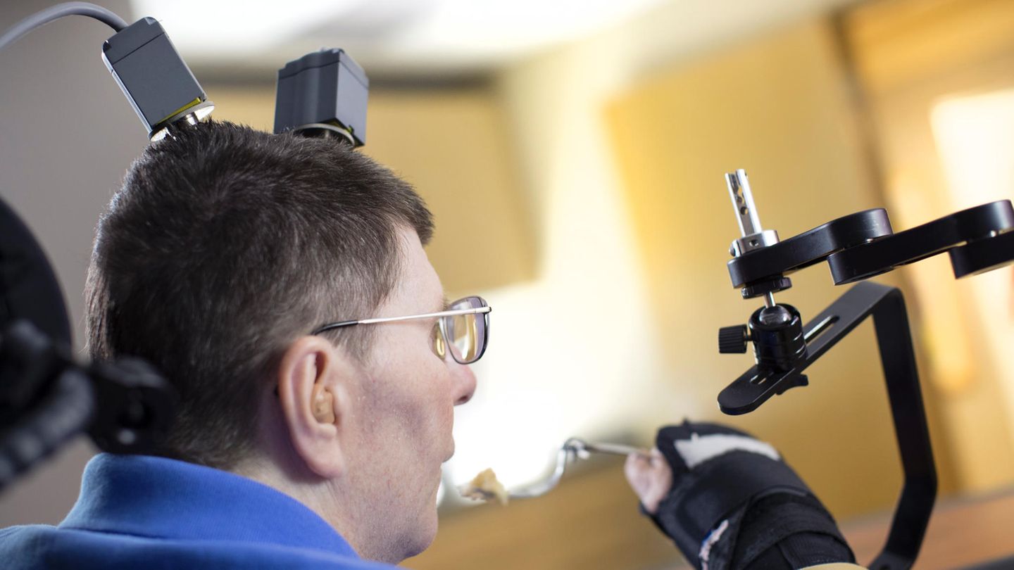 Neuroprothese: Durchbruch bei Behandlung von schwersten Lähmungen