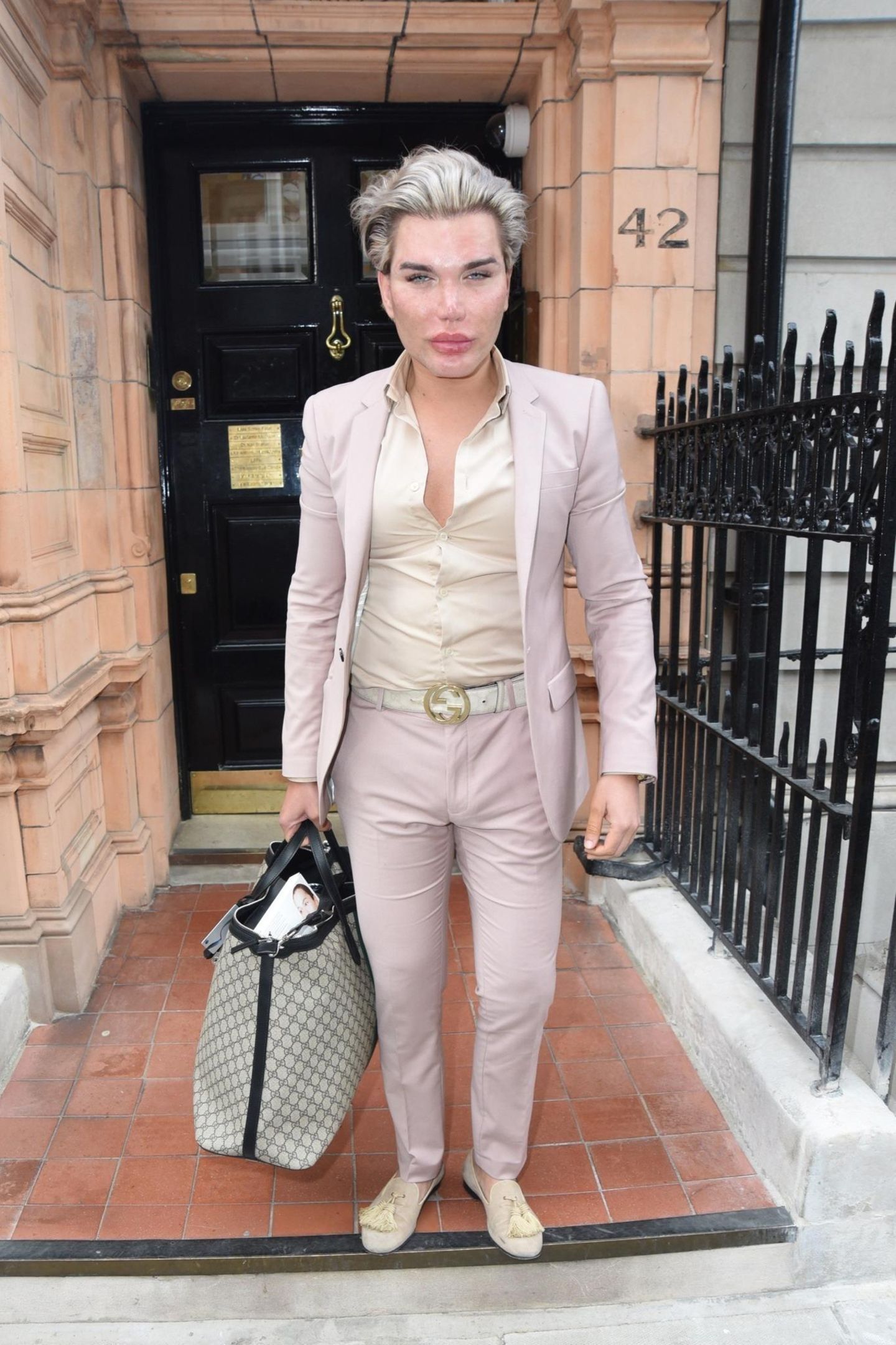 Ken-Doppelgänger Rodrigo Alves lässt sich von Dr Deniz Kanliada in London das Gesicht unterspritzen