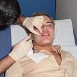 Ken-Doppelgänger Rodrigo Alves lässt sich von Dr Deniz Kanliada in London das Gesicht unterspritzen