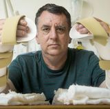 Der Brite Chris King (57) schrieb Geschichte: Als erster Patient in Großbritannien erhielt er im Juli 2016 gleich zwei Spenderhände. King hatte große Teile seiner Hände bei einem Arbeitsunfall mit einer Metallpressmaschine verloren. Nur seine Daumen blieben bei dem Unglück verschont.