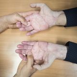 Über den Spender der Hände ist kaum etwas bekannt. Nur so viel: Er muss in der Statur in etwa Chris King geähnelt haben. Den behandelnden Ärzten war es wichtig, dass sich die Spenderhände optimal in das Erscheinungsbild des Patienten einfügten.