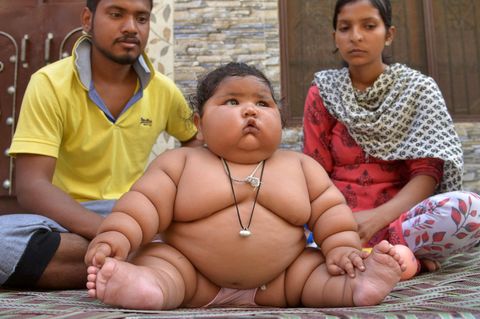 Ein sehr dickes Baby sitzt nur mit Windel vor seinen Eltern. Chahat Kumar wiegt mit acht Monaten schon 17 Kilo