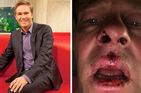 NDR-Moderator Hinnerk Baumgarten am Ballermann geschlagen