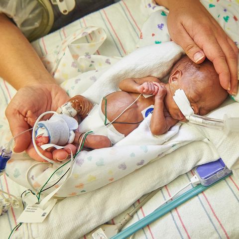 Ein zu früh geborenes Baby im Children's Hospital of Philadelphia in Philadelphia, USA