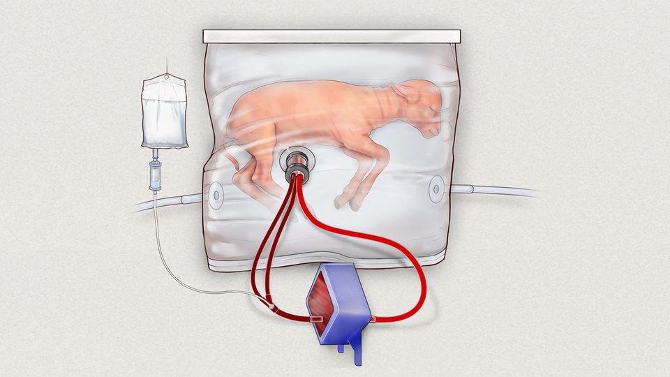 Lämmchen in einer Art künstlicher Gebärmutter Die Illustration vom Children's Hospital of Philadelphia zeigt ein Lamm in einem Beutel, einer Art künstlicher Gebärmutter