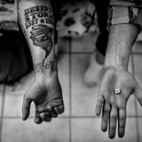 Vier Backenzähne hat Connie Sue Foss bereits verloren, so sehr knirscht sie im Schlaf unter Albträumen mit den Zähnen